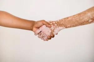 Two individuals with white skin shaking hands in a professional setting