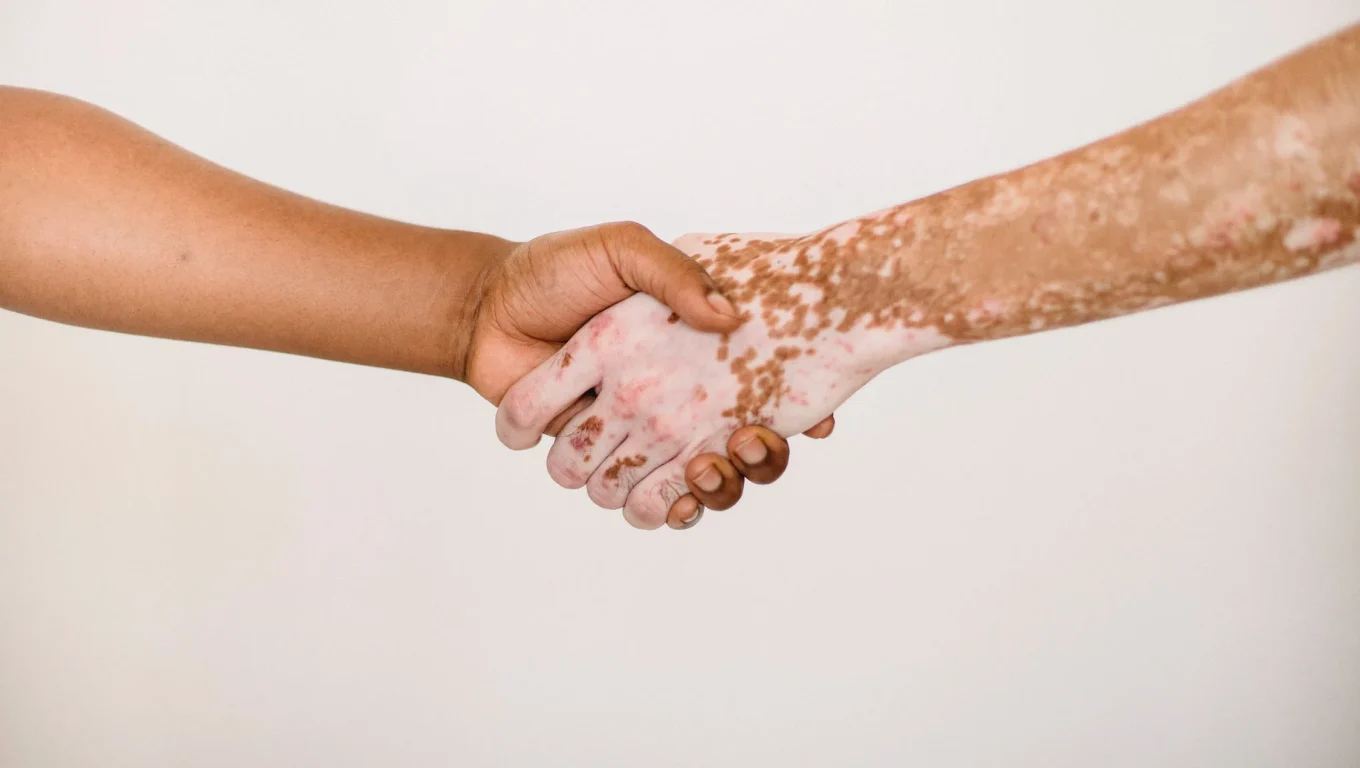 Two individuals with white skin shaking hands in a professional setting